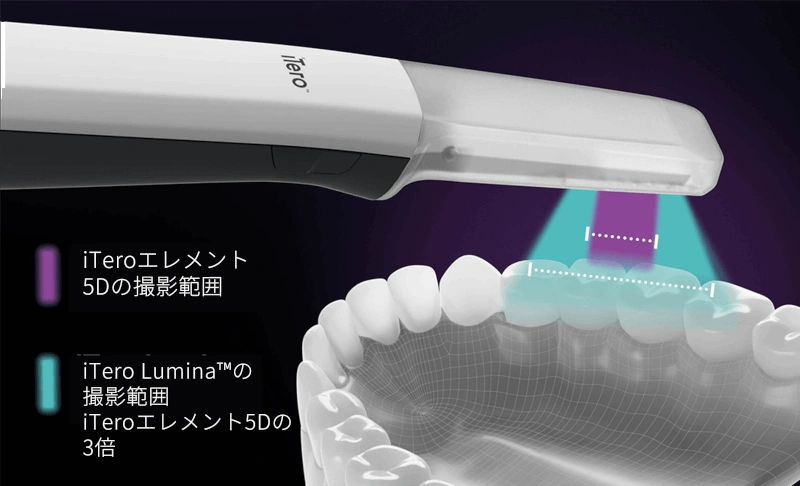 最新機器「iTero Lumina」を導入し精密な歯型取りが可能